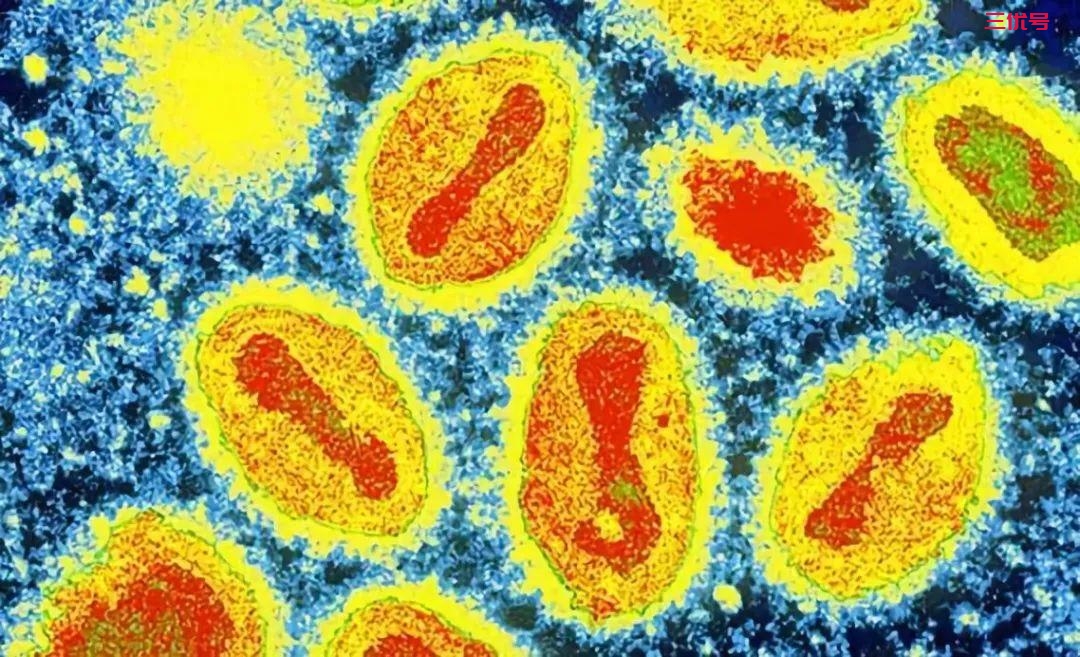 「科普」十大致命病毒，埃博拉只能排第二，第一名曾屠杀上亿人