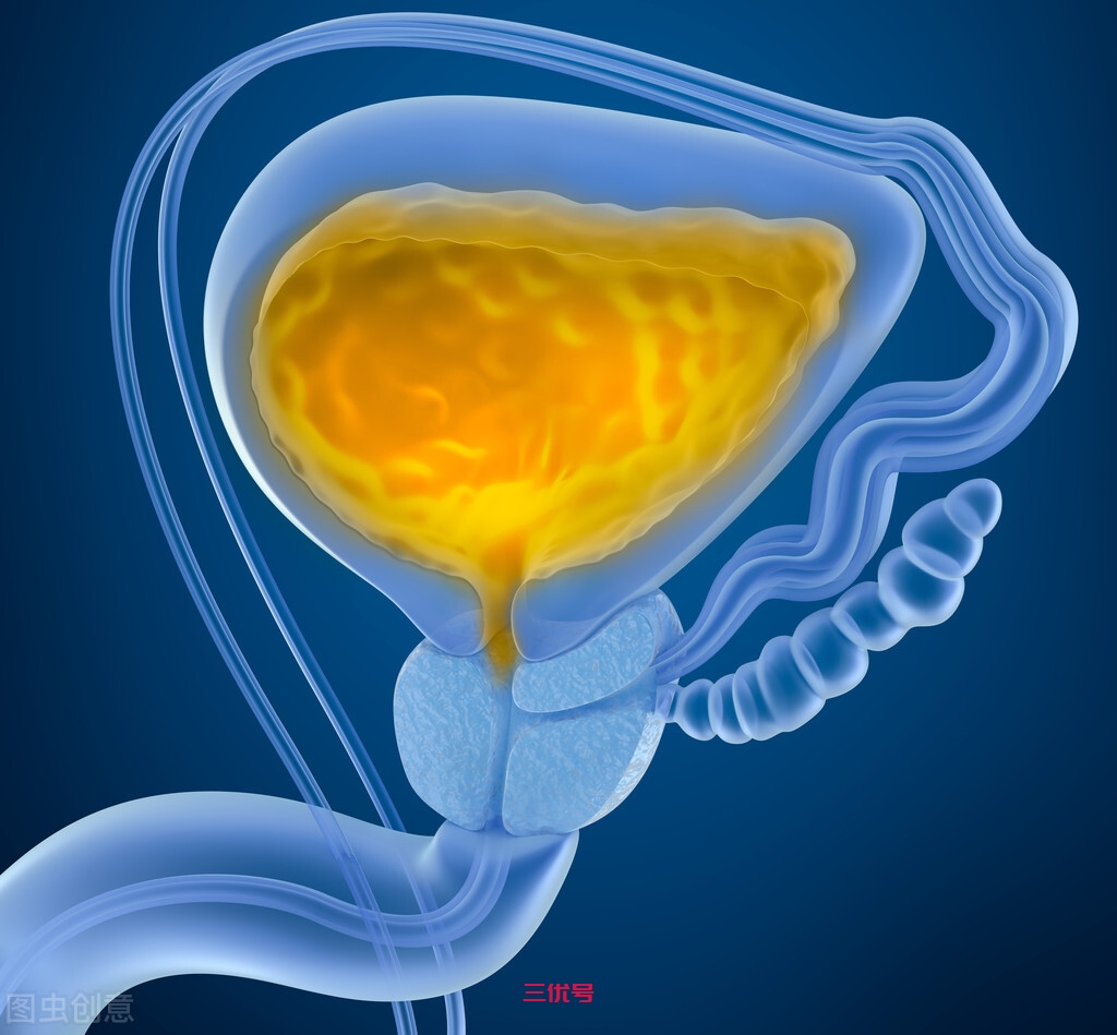 膀胱癌上身，身体会发出一些警示信号，不止是尿频、尿急、尿痛