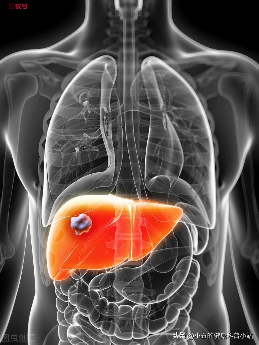 肝脏囊肿到底是什么？需要治疗吗？会癌变吗？本文告诉你