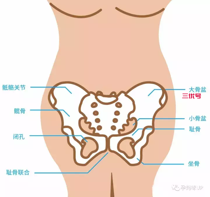 大腿根部疼痛？抬腿困难？也许是耻骨分离惹的祸！